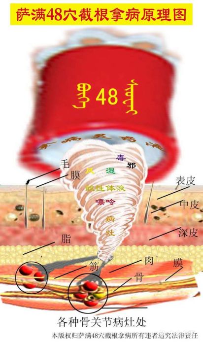 萨满48穴截根拿图片 - 第4张
