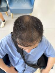 点击看大图 -大麦微针植发全国连锁