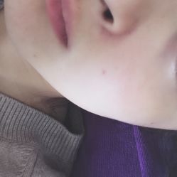 -南京健丽·去眼袋医疗美容机构