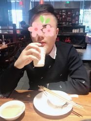 点击看大图 体验前-大麦微针植发丨全国连锁