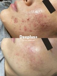 点击看大图 -Deeplus+韩国皮肤管理한국피부관리·C:Lab肌肤实验室