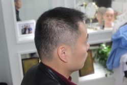 -大麦微针植发丨全国连锁