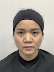 -广州健丽·去眼袋医疗美容机构