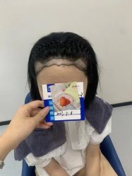 -大麦微针植发全国连锁