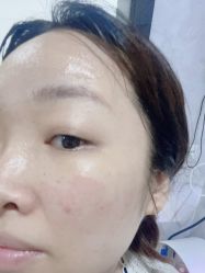 体验后-深圳新建安医疗美容门诊部