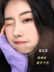 -广州美莱医疗美容医院
