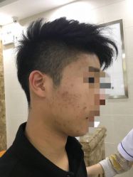 点击看大图 -痘博士广州·全国连锁祛痘机构