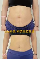 -Lily纤美·科技减脂中心
