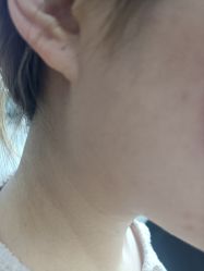体验后-广州美莱医疗美容医院