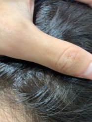 -熙朵美学植发连锁