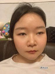 体验后-丽都整形美容医院·全国连锁旗舰店