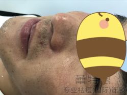 点击看大图 -蕾特恩专业祛痘·皮肤管理