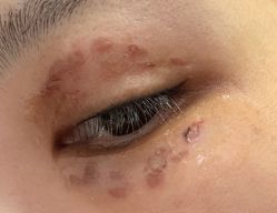 -丰联丽格医疗美容·联合丽格眼整形中心