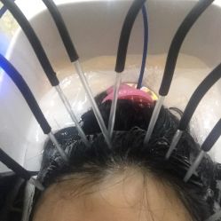 -再出发防脱发白发理疗中心