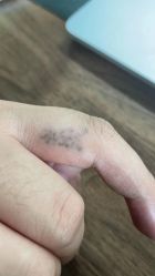 -净肤洗纹身