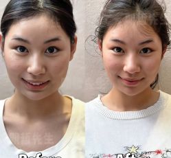 -颜和骨正&明星徒手小颜整骨