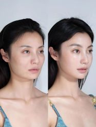 -上海伊莱美医疗美容医院
