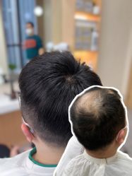 -极客侠男士假发定制补发