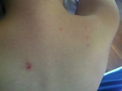 一家三口均被跳蚤咬了无数口-屋顶顶城市·江景酒店-客房部