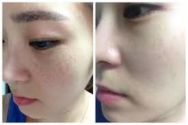 -SKINIST丽铂医疗美容