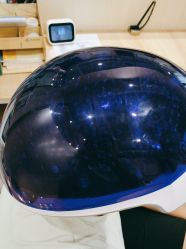 点击看大图 -碧莲盛·不剃发植发