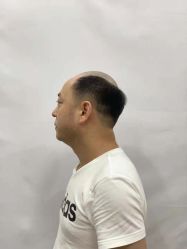 -唐风采假发补发定制