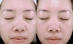 -SKINIST丽铂医疗美容