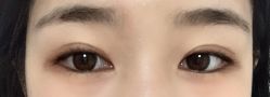 -丰联丽格医疗美容·联合丽格眼整形中心