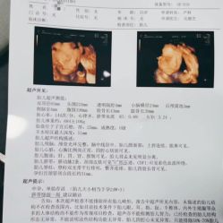 -白领安琪儿妇产医院•早孕•产检•月子中心