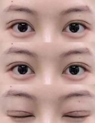 -东莞西妃整形美容医院