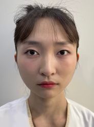 体验前-Yestar艺星医疗美容医院