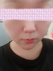 体验后-MLP美丽派·问题肌疗愈中心