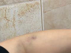 -瑞慈体检上海徐汇机构