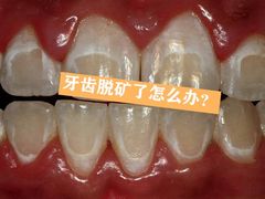 -团圆口腔·种植中心(锦江院区)