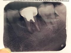 -广州市红十字会医院(总院)