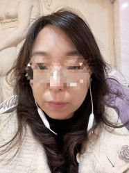 体验后-上海宏康医院·医疗美容科