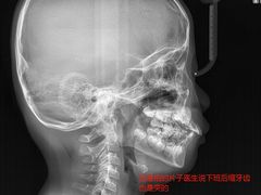 -柏乐口腔(南宁总院)