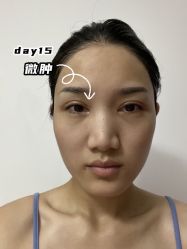 -上海时光整形外科医院