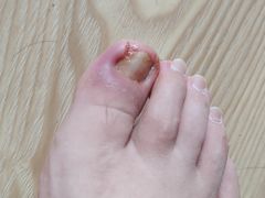 -世龙世家甲沟炎·灰指甲·嵌甲矫正·修脚(武侯区双楠店)