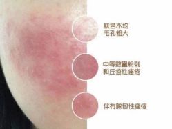 -美肤盾祛痘·问题肌头疗管理中心