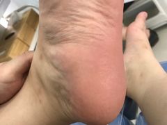 -世龙世家甲沟炎·灰指甲·嵌甲矫正·修脚(武侯区双楠店)