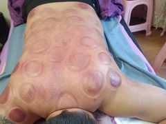 -沈师傅盲人按摩工作室(密三小区店)