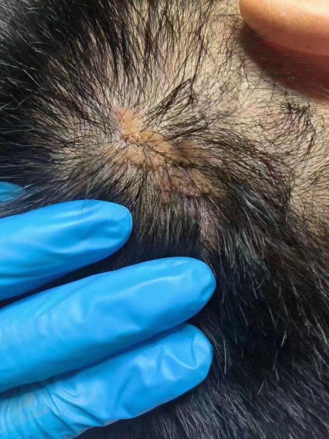 1.病因:头皮扁平疣通常由人乳头瘤病毒感