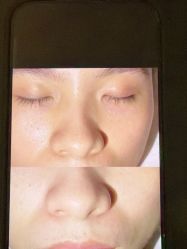 点击看大图 -栖SPA·ONDA ·美芙炫·海菲秀科技美肤中心