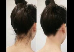 -小梨·OndaPro·专业脱毛连锁机构