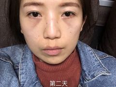 体验后-上海华安整形外科门诊部