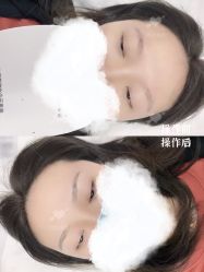 -西施无菌半永久纹绣眉眼影唇轻增发纹发际线