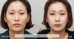 -CMS西美斯·美式医疗美容