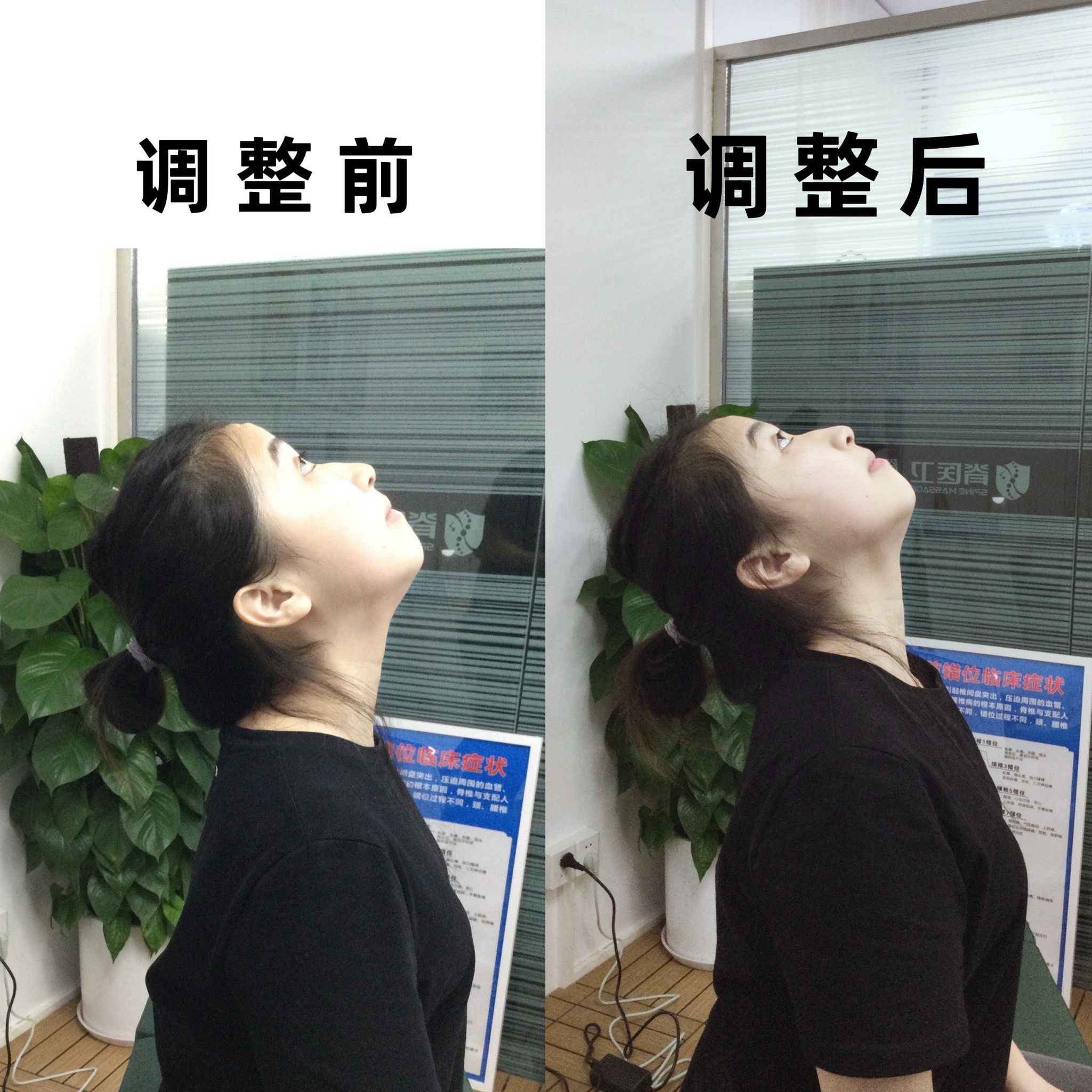 这段时间脖子抬起来颈椎后面有点不舒服,抬不起来的感觉,去了好几个