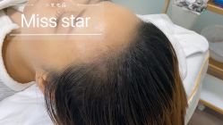 -MISS STAR·半永久纹眉·发际线·美瞳线